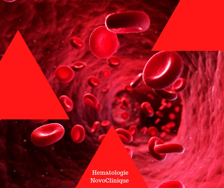 Read more about the article Hemofilia, o tulburare de coagulare