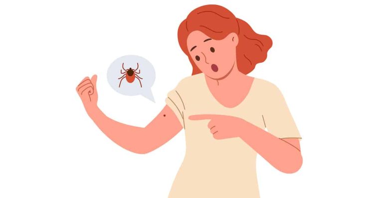 Read more about the article Protecția anti-căpușe: ghid complet pentru copii și adulți